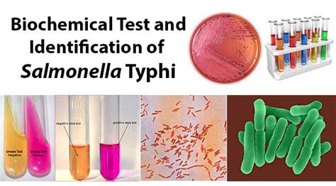 Biochemical Test and Identification of Salmonella Typhi.